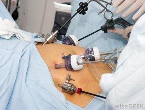  • Laparoscopic surgery offers new options for patients 