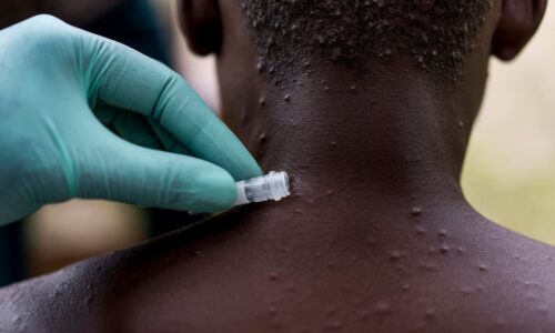 Mpox vaccination begins today in seven states